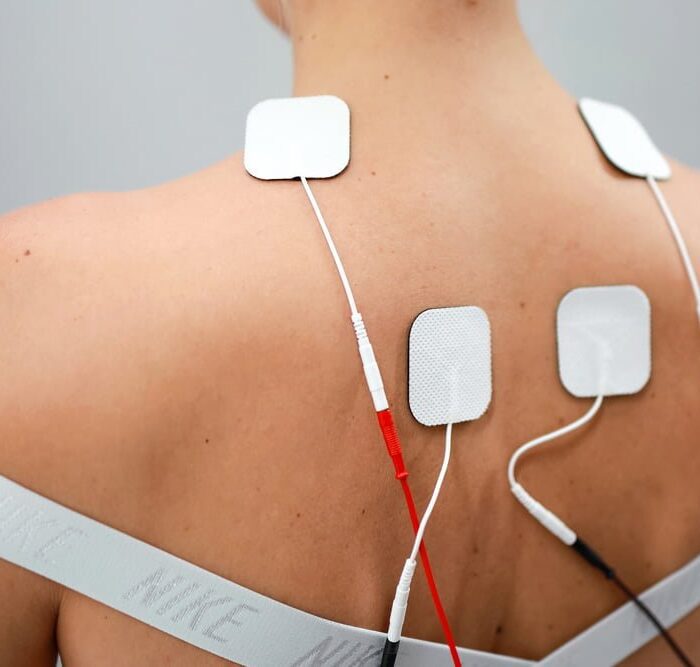 Electrotherapy